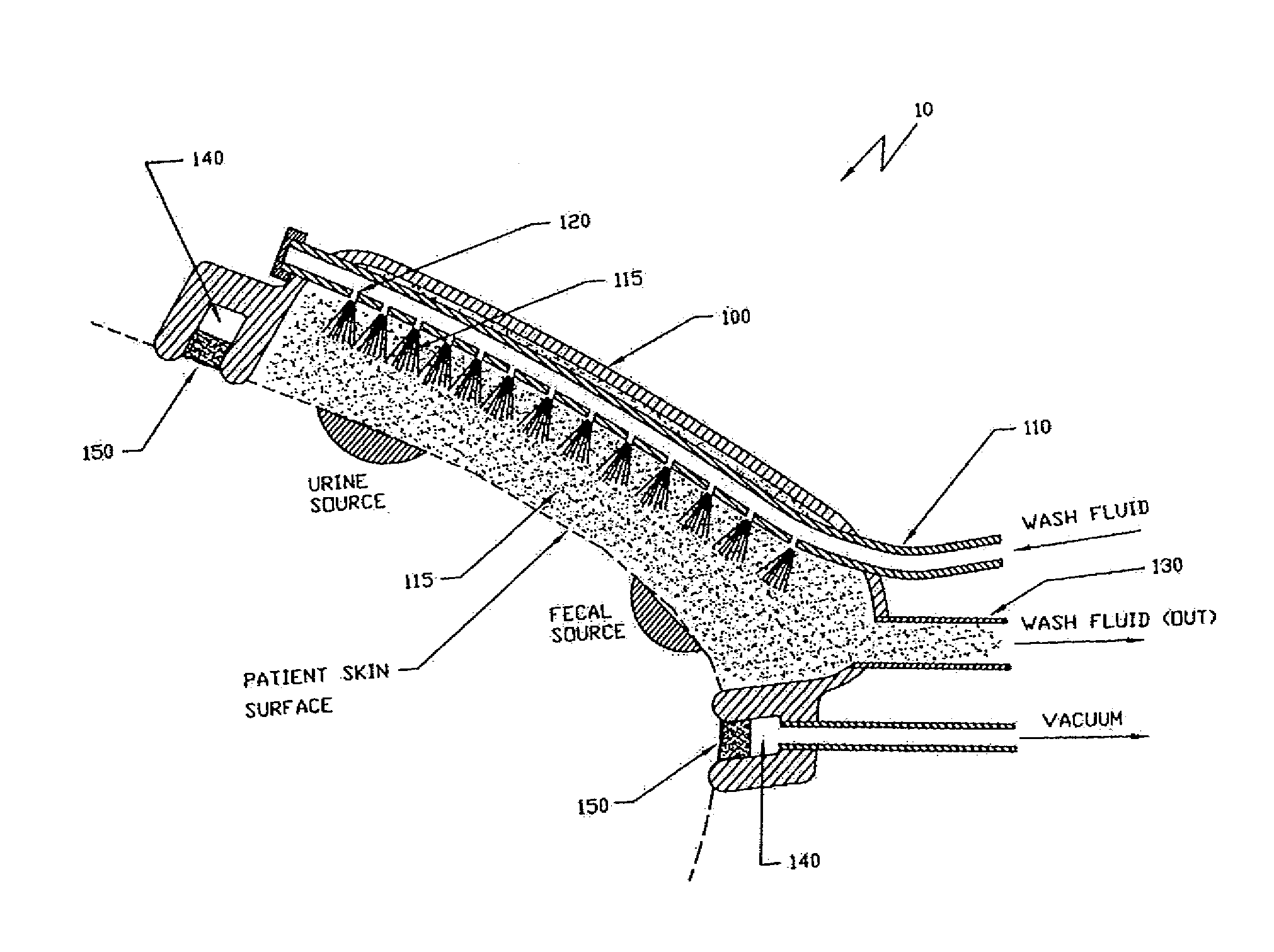 Apparatus and Method for the Removal and Containment of Human Waste Excretion