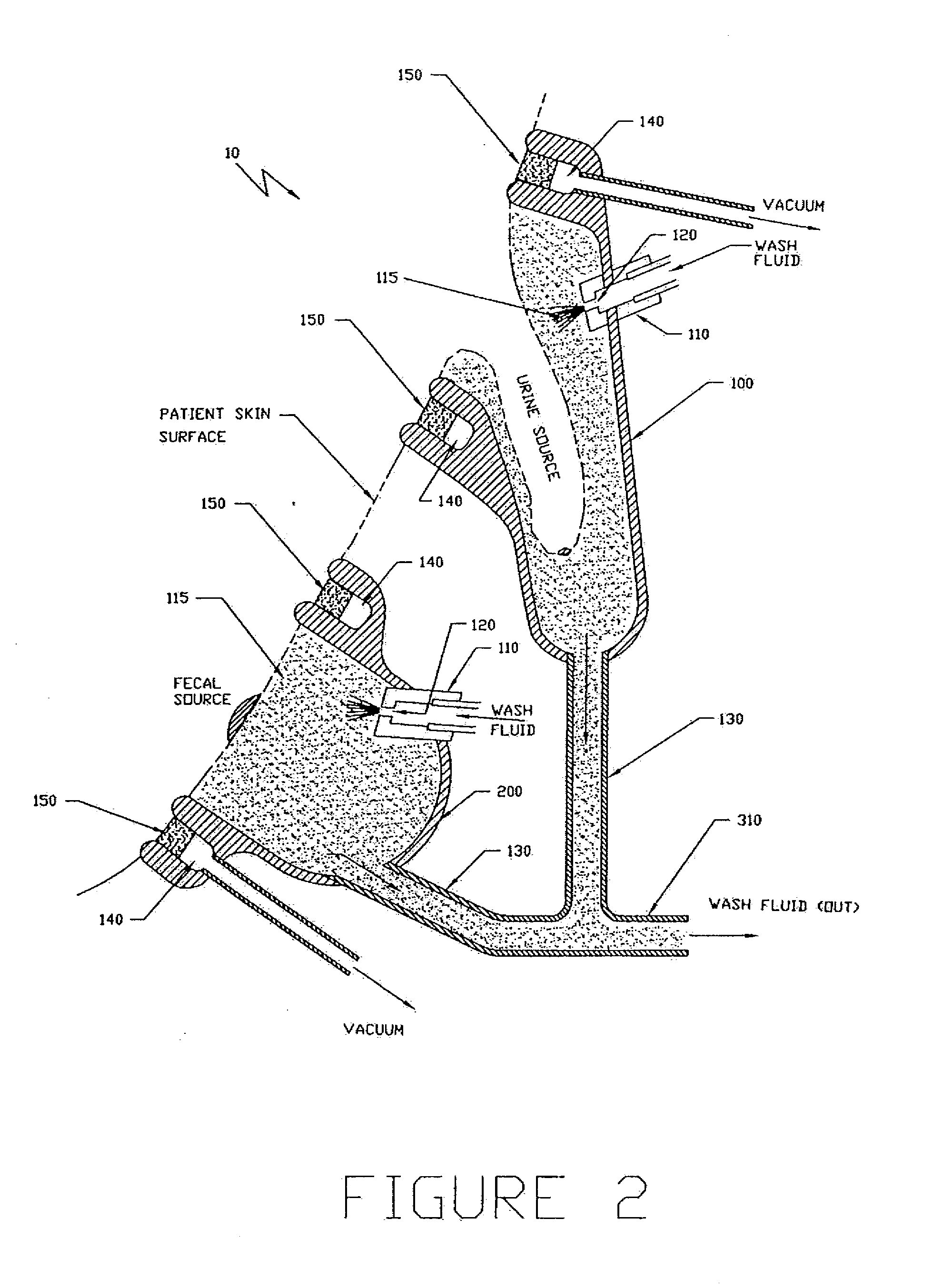 Apparatus and Method for the Removal and Containment of Human Waste Excretion