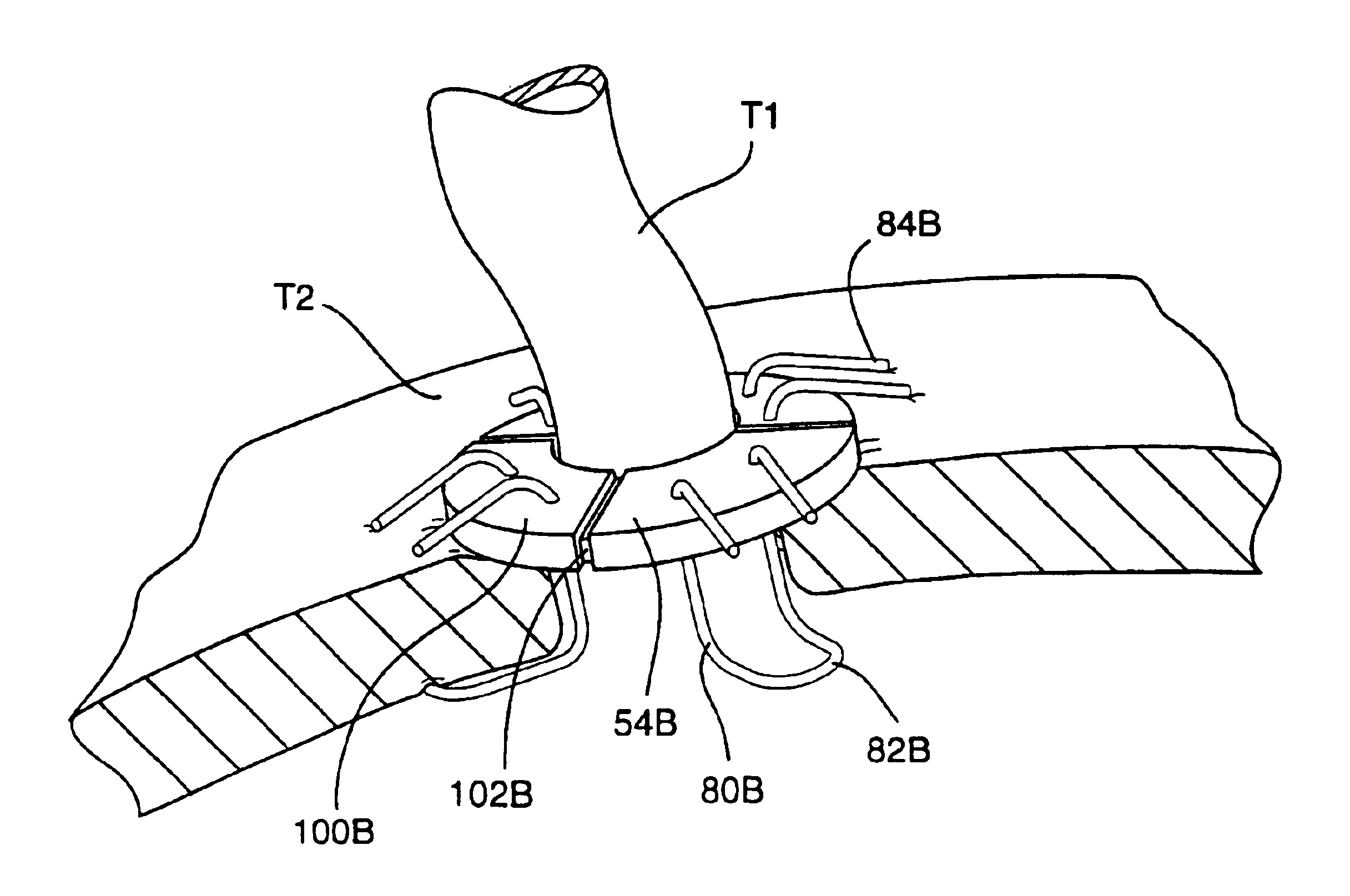 System for performing vascular anastomoses