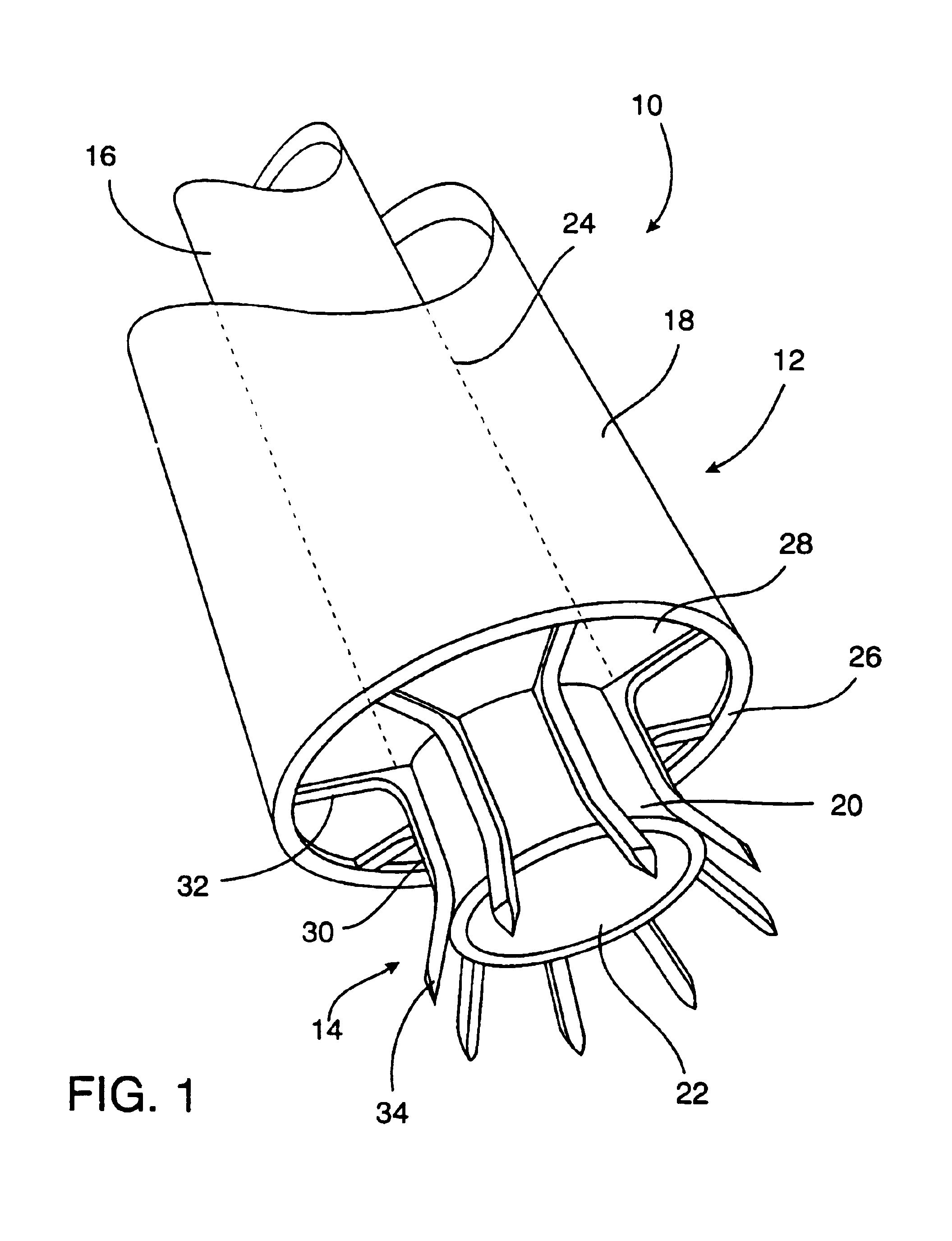 System for performing vascular anastomoses