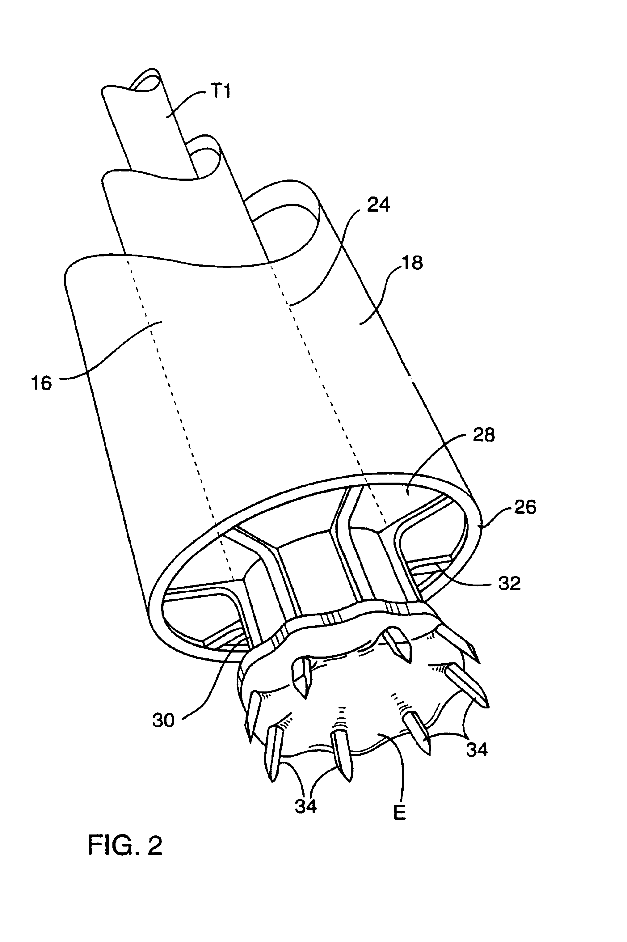 System for performing vascular anastomoses