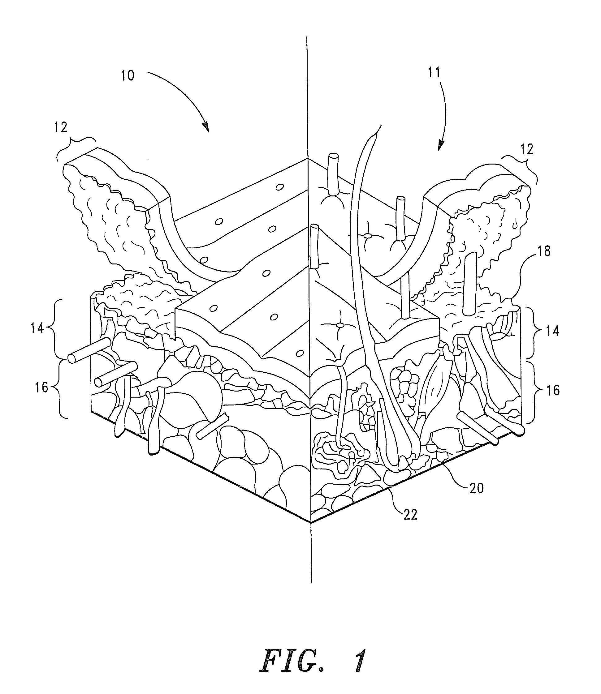 Systems, Compositions and Methods for the Treatment of Alopecia