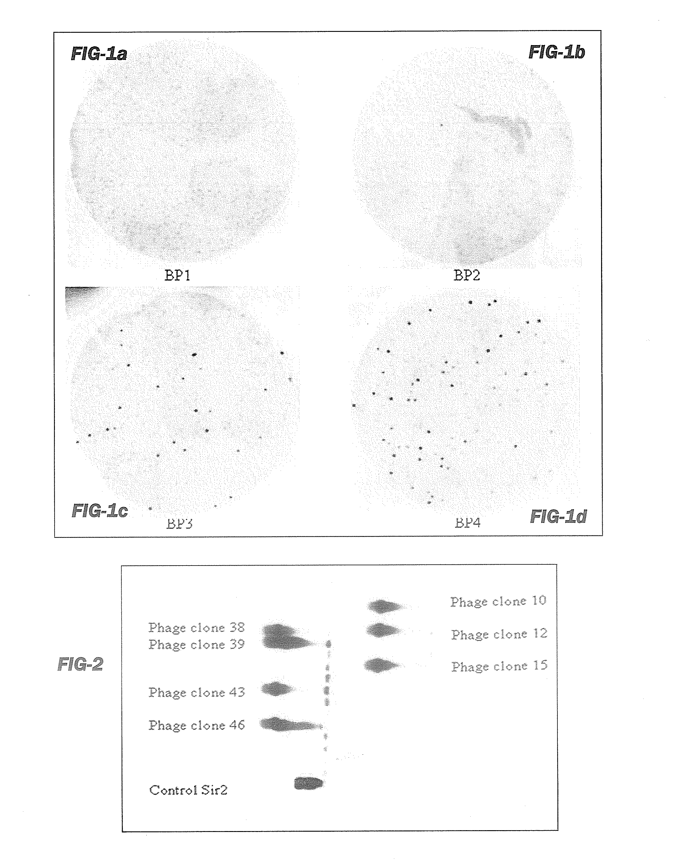 Neoepitope detection of disease using protein arrays