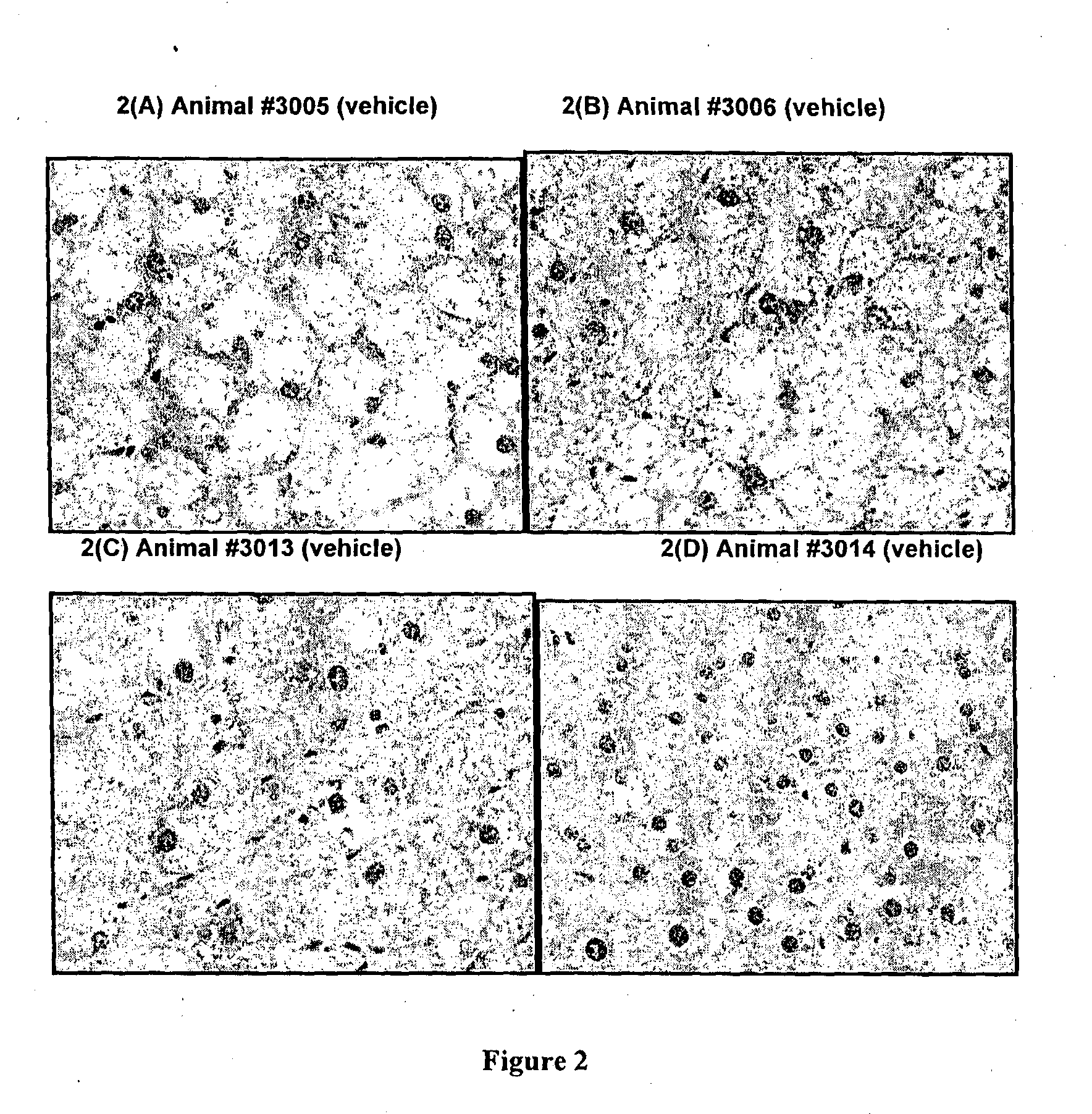 Method of improving liver function