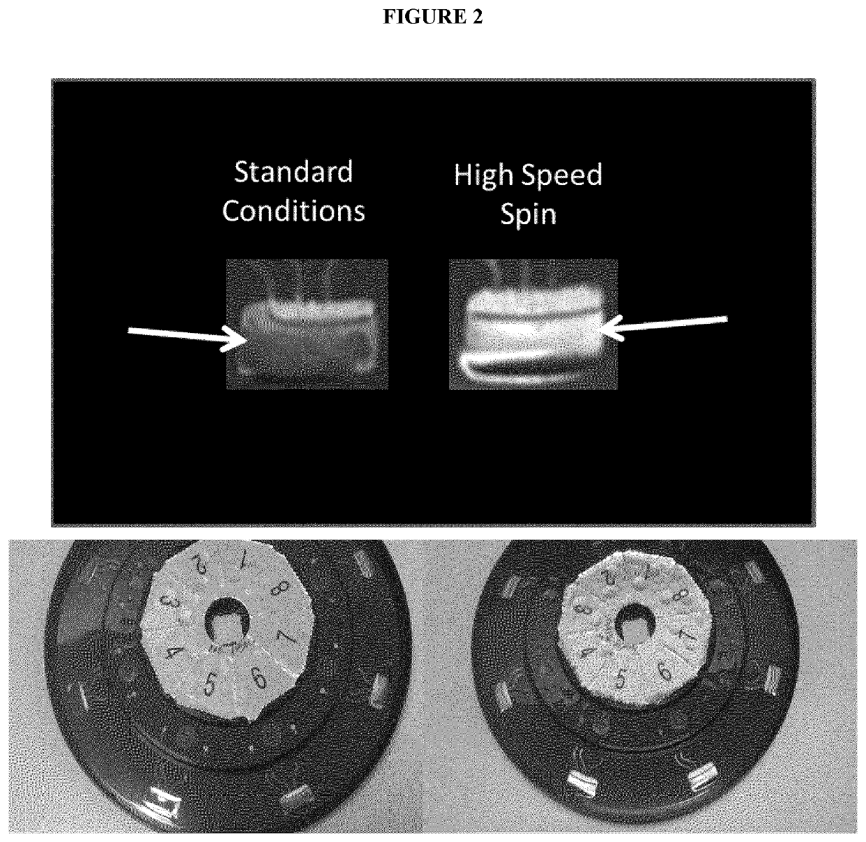 Amplification and detection of nucleic acids in a biological sample