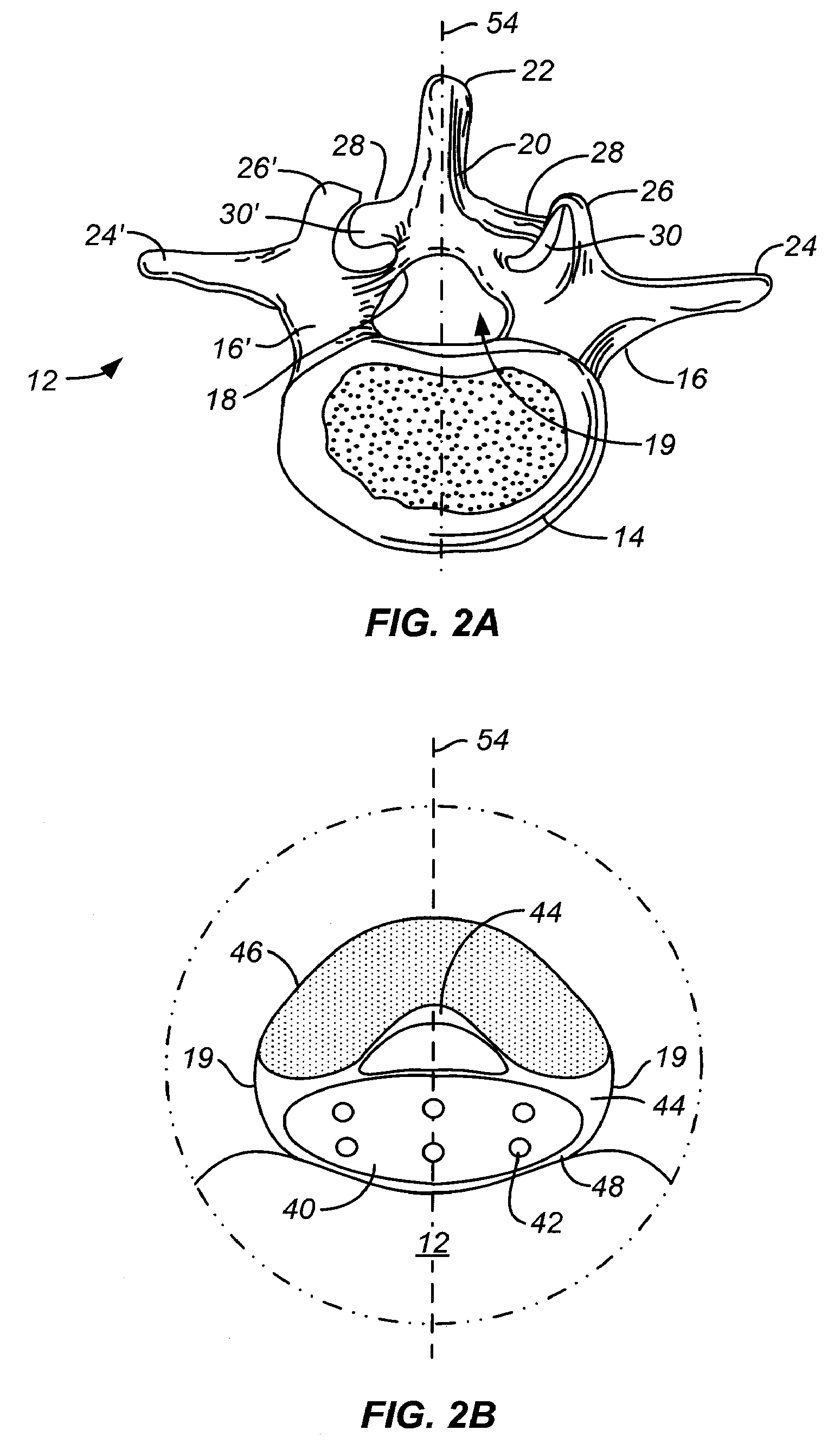 Percutaneous Devices for Separating Tissue, Kits and Methods of Using the Same