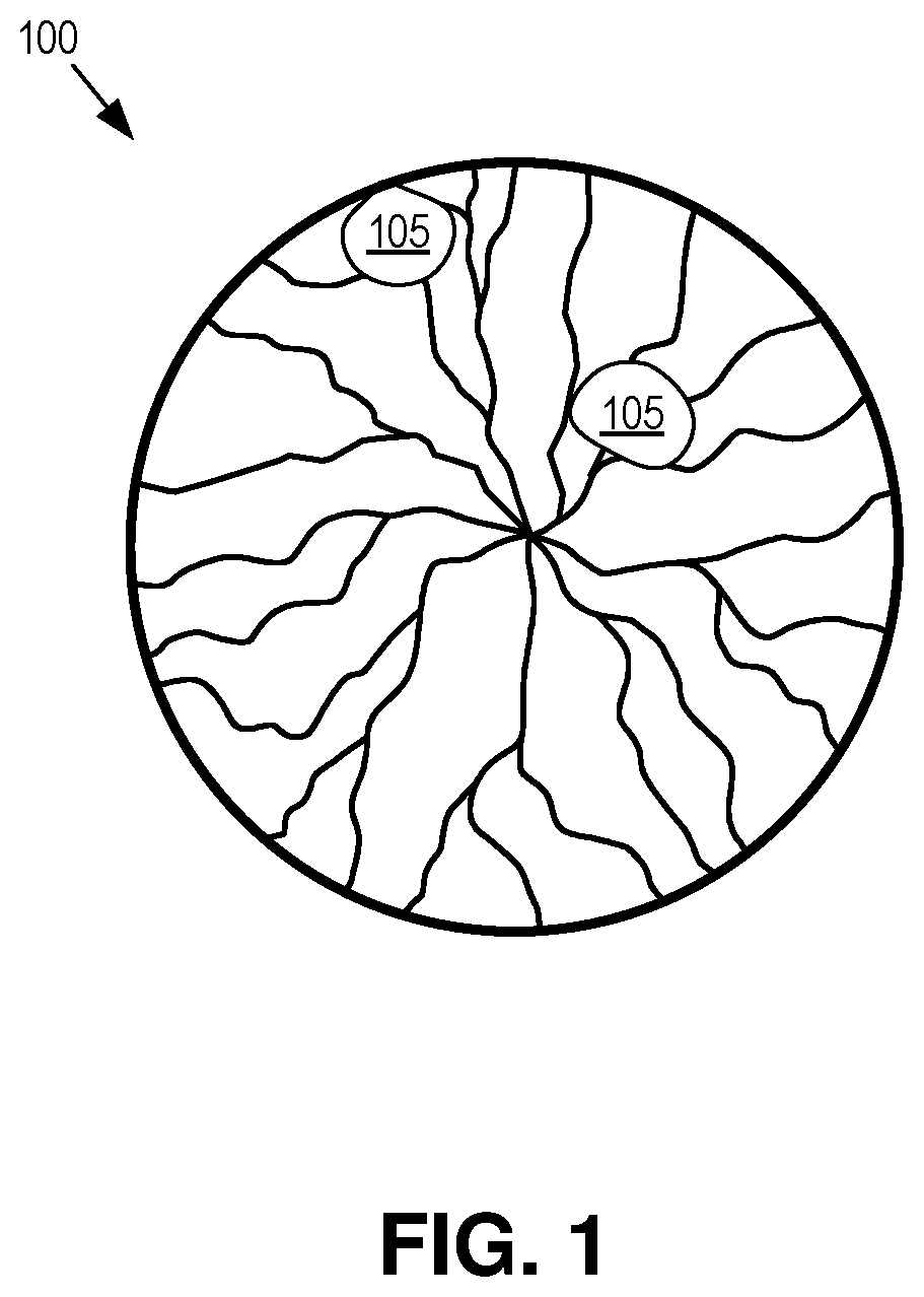 Dynamic eye fixation for retinal imaging