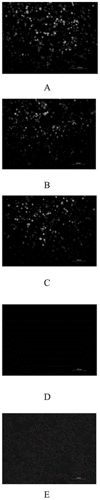 An anti-Ebola-virus immunoglobulin F(ab')2 and a preparing method thereof