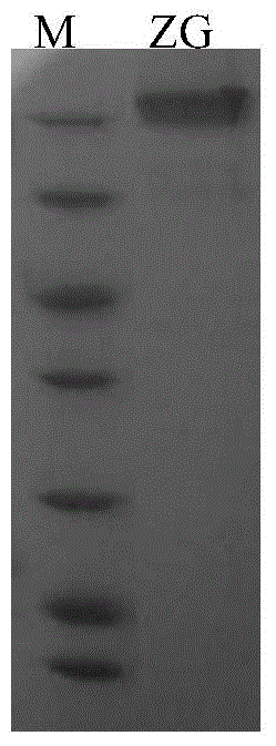 An anti-Ebola-virus immunoglobulin F(ab')2 and a preparing method thereof