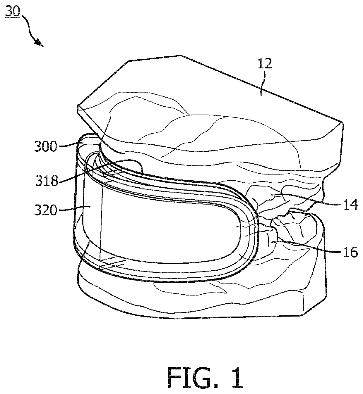 Oral care illumination device with backlight module and method of use