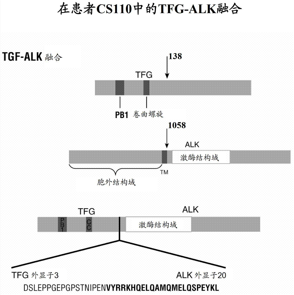 ALK (Anaplastic Lymphoma Kinase) for gene deletion and mutant in human solid tumor