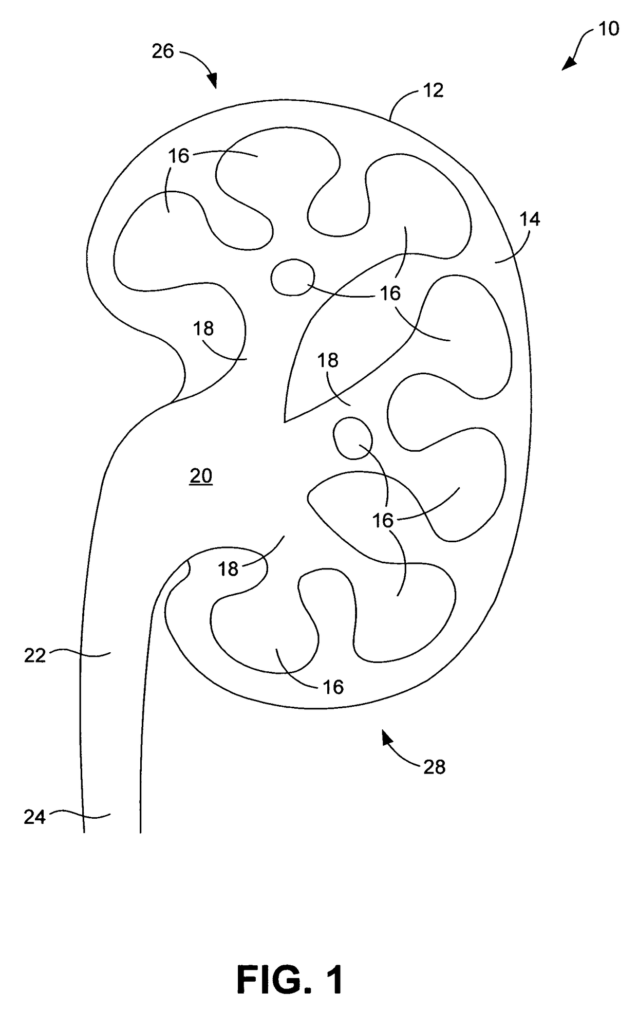 System and method for marking body cavities