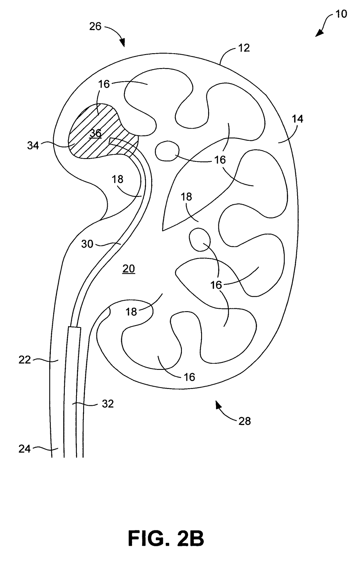 System and method for marking body cavities