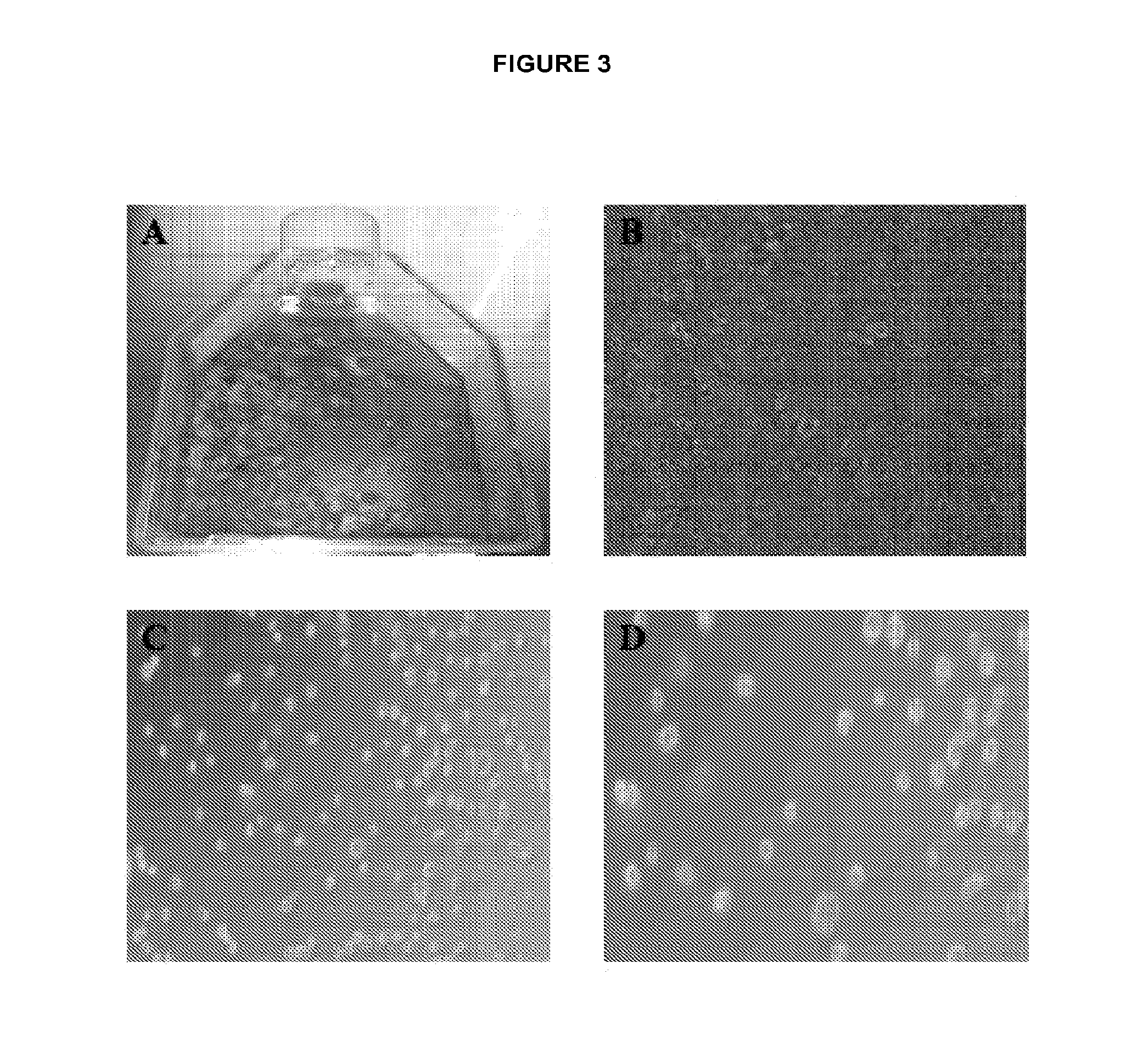 Human disc tissue