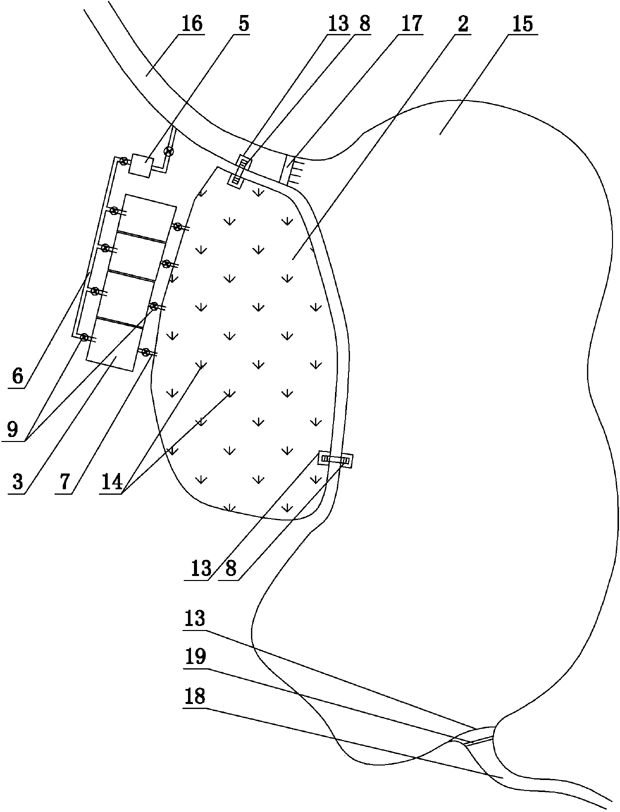 Large-water-surface low-cost healthy high-efficiency bighead cultivating method