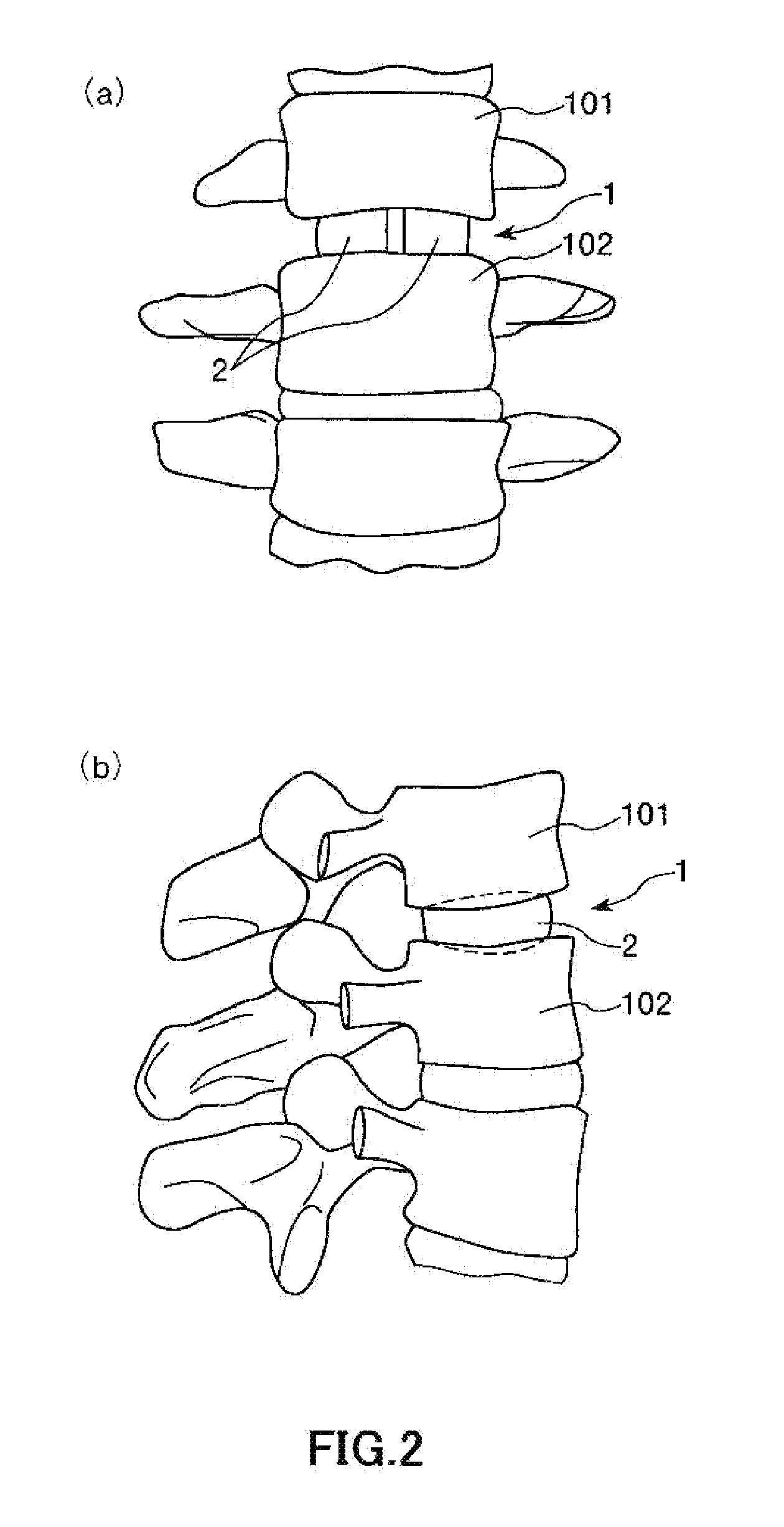 Vertebral body spacer