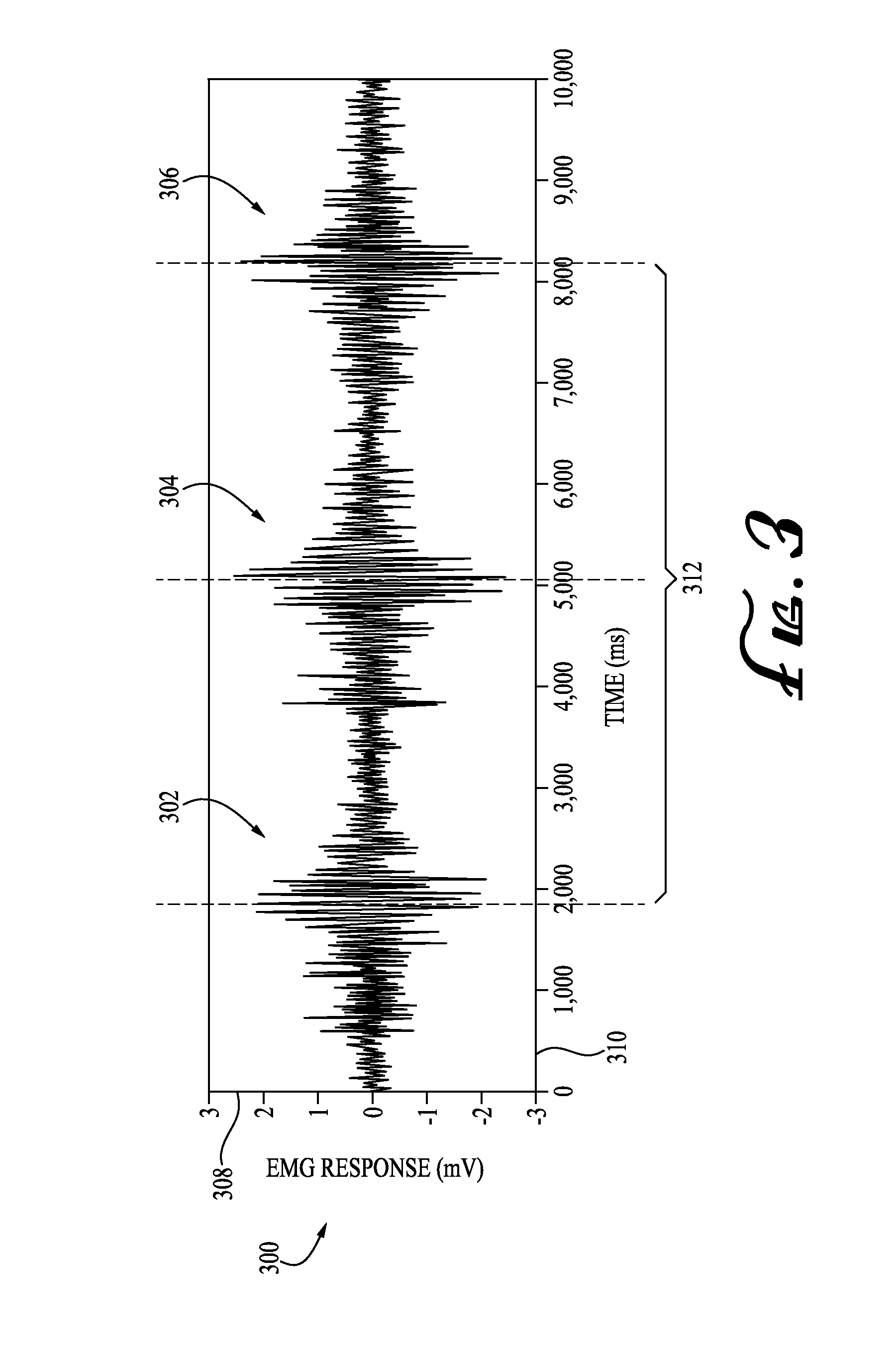 Method of detecting reversible nerve injury