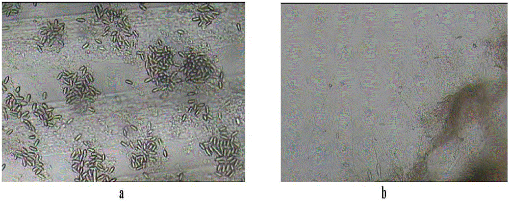 A method for isolating toxin protein from white jellyfish tentacles