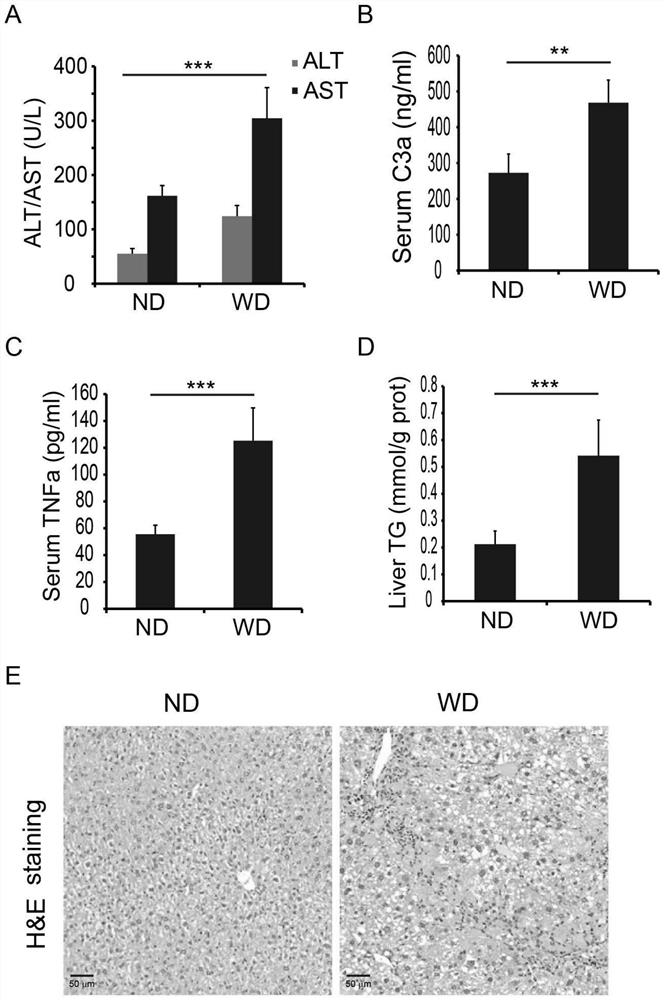 tiRNA-Val antisense strand inhibitor and application thereof