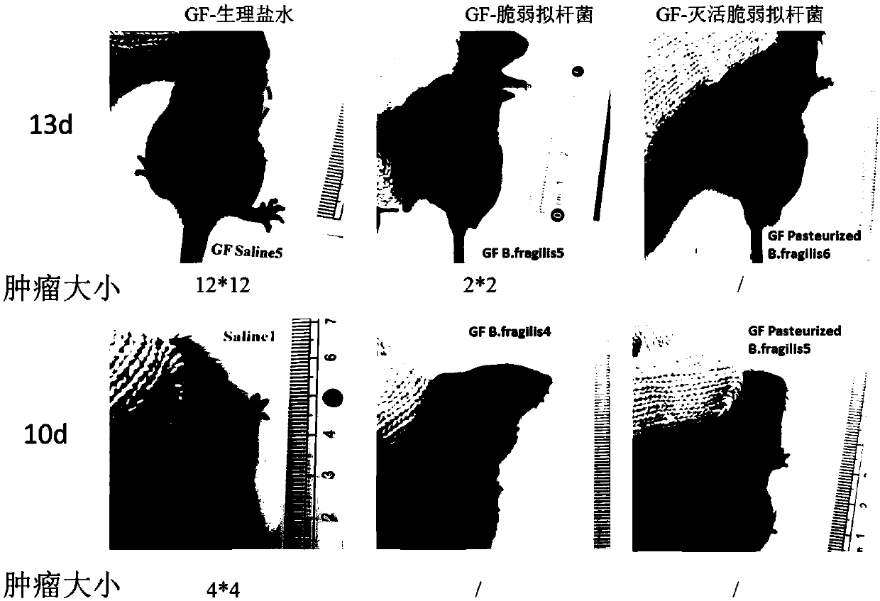 Application of bacteroides fragilis to preparation of medicines for treating and preventing tumors