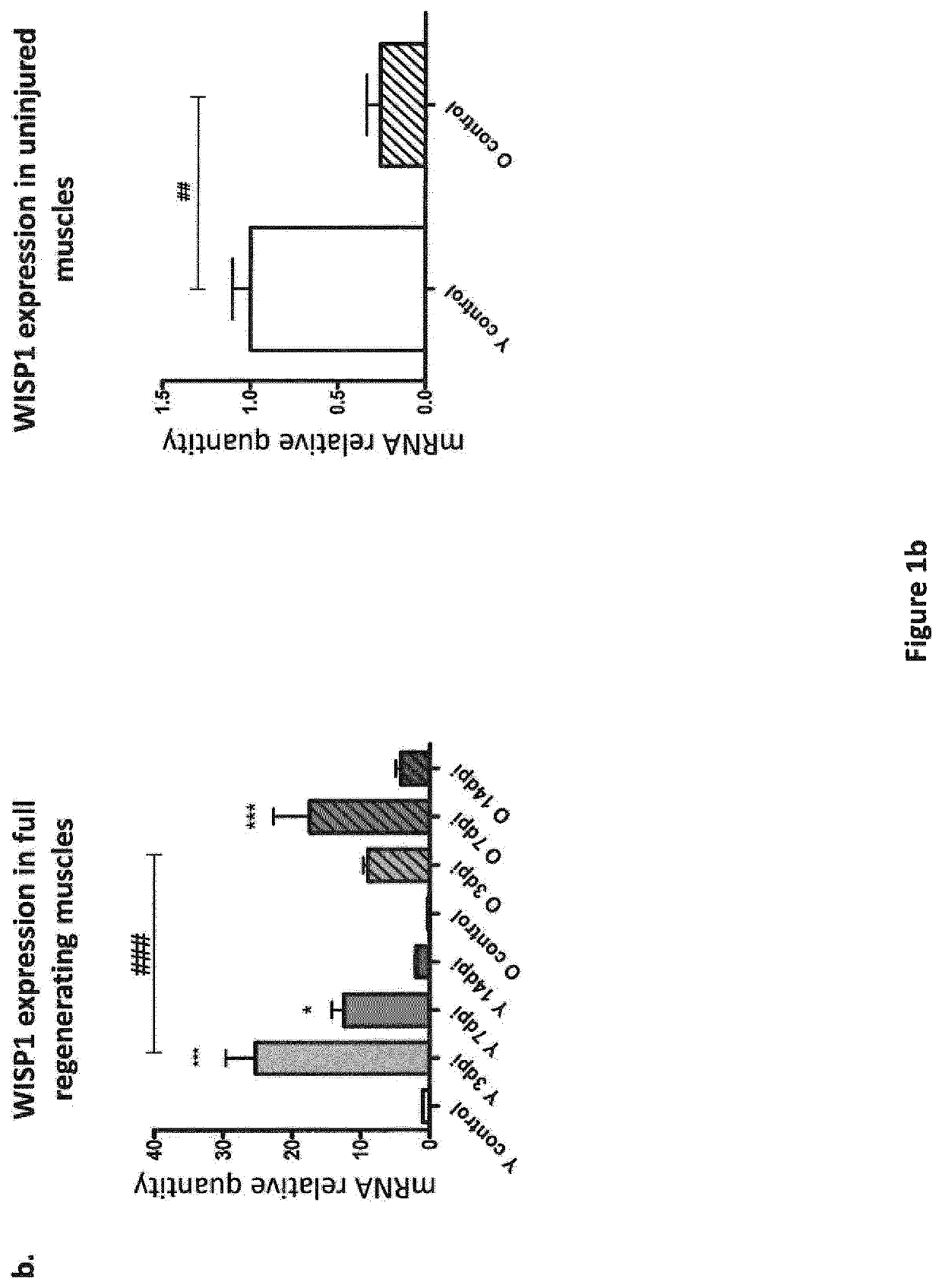 Methods for treating sarcopenia and muscle injury