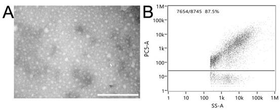 A kind of exosome drug delivery system and its preparation method and application