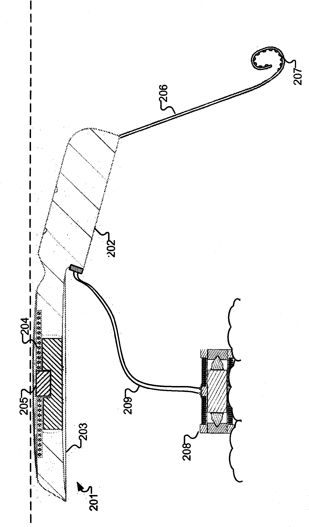 Multipath stimulation hearing systems