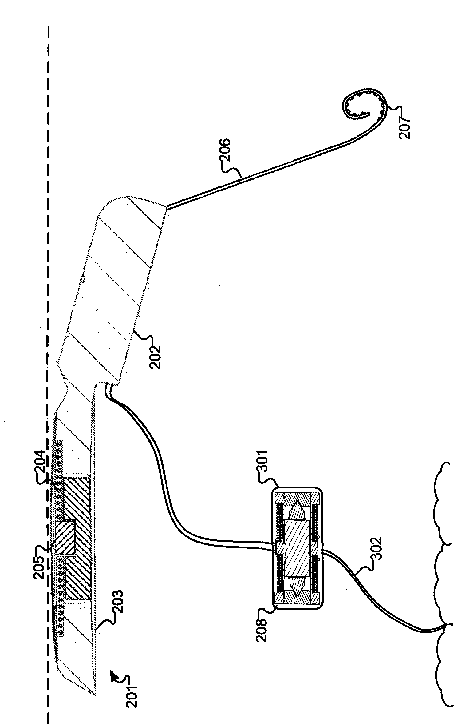 Multipath stimulation hearing systems