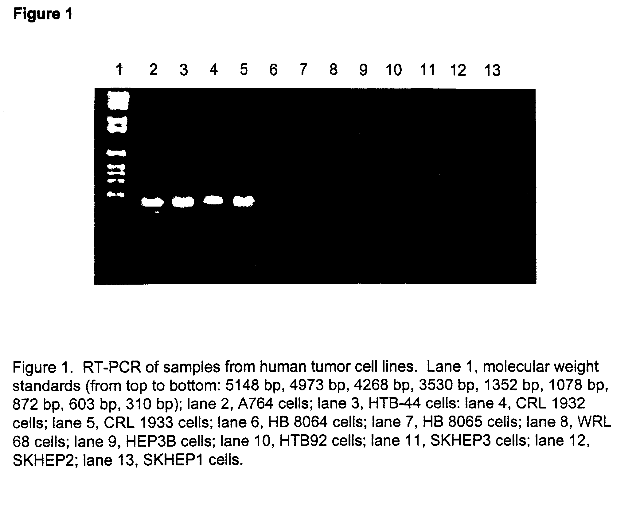 Methods for predicting sensitivity of tumors to arginine deprivation