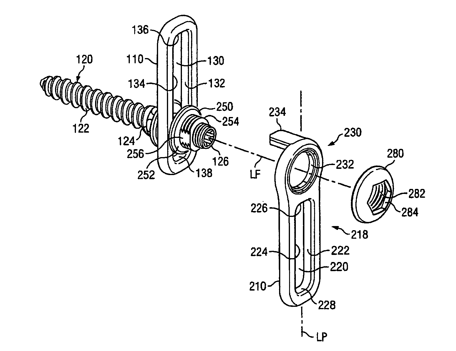 Revision fixation plate and method of use