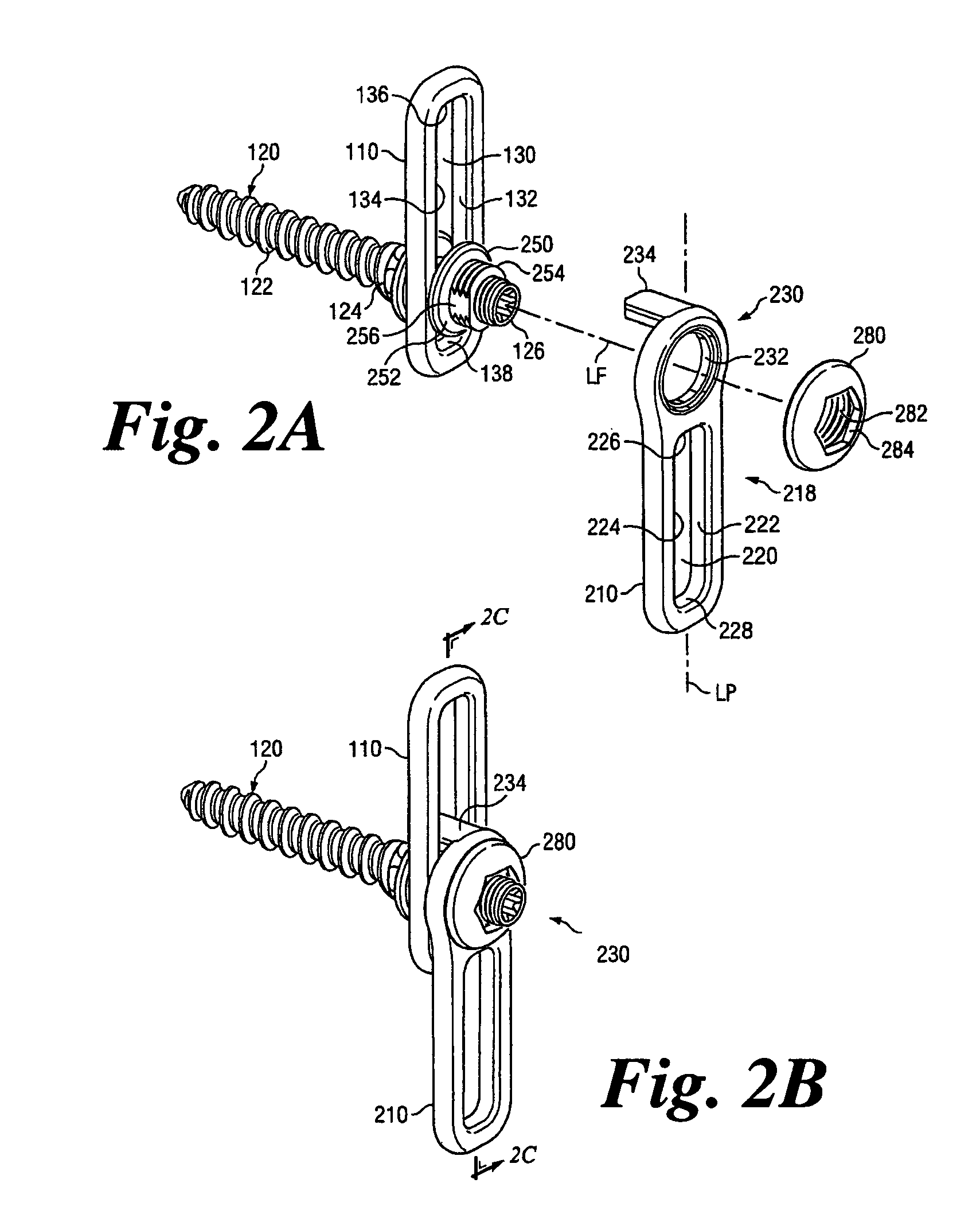 Revision fixation plate and method of use