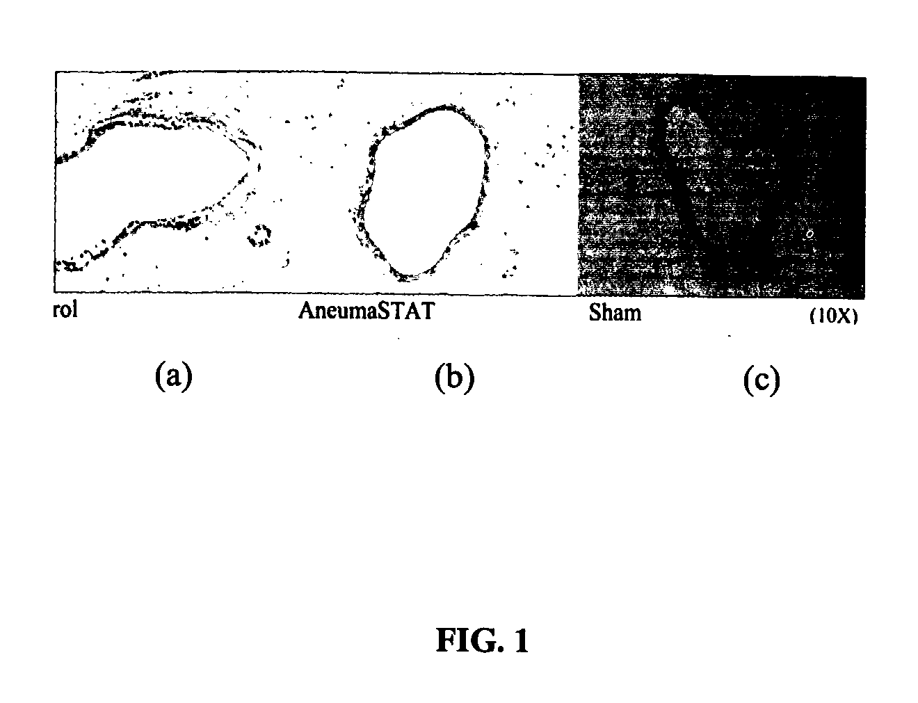 Methods For Treating or Preventing a Vascular Disease