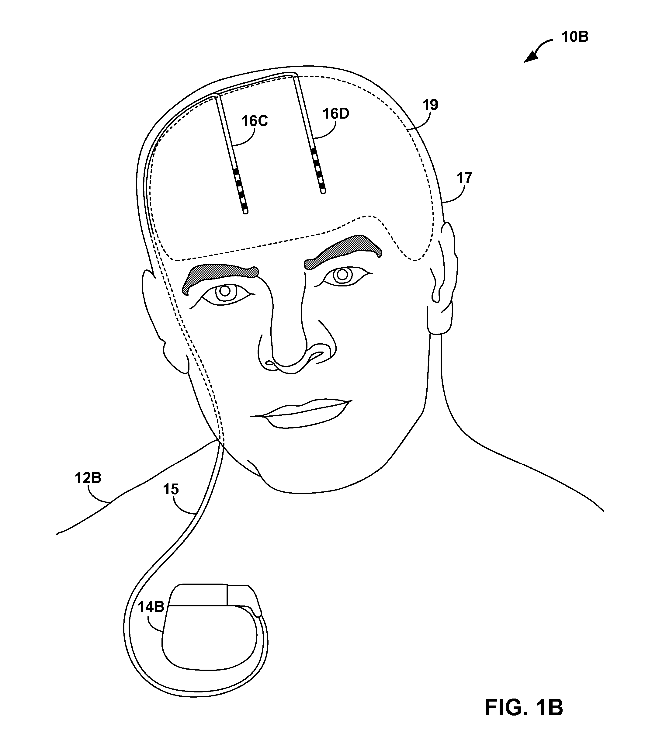 Collecting activity and sleep quality information via a medical device