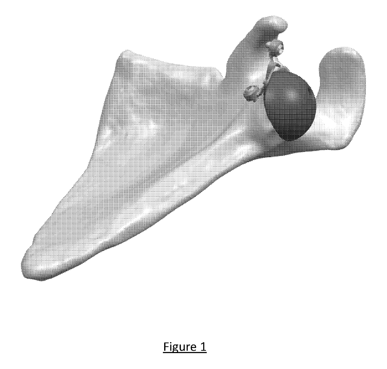 Platform rtsa glenoid prosthesis with modular attachments capable of improving initial fixation, fracture reconstructions, and joint biomechanics