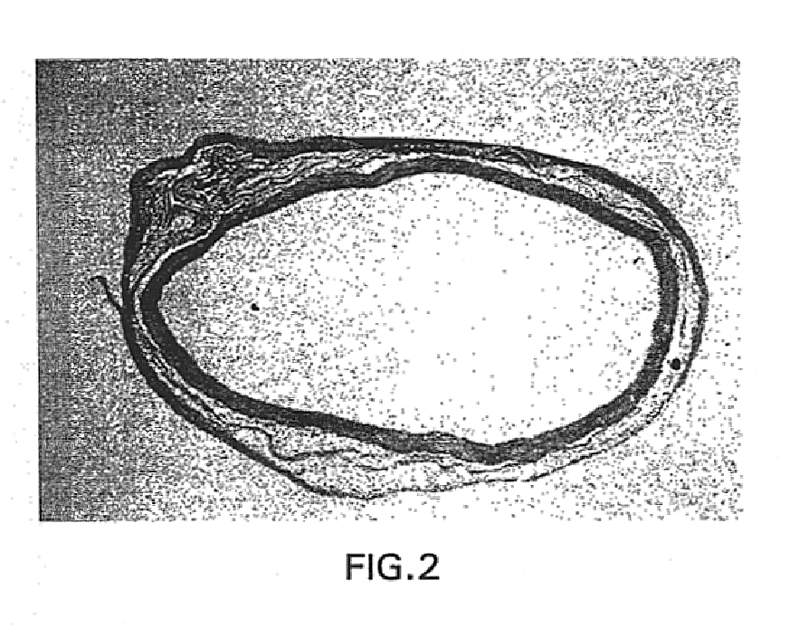 Method for treating diseased or damaged organs