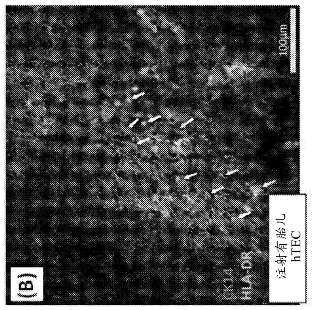 Hybrid thymus, methods of making and methods of use for inducing xenograft tolerance, restoring immunocompetence and thymus function