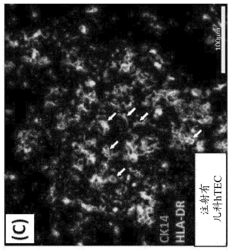 Hybrid thymus, methods of making and methods of use for inducing xenograft tolerance, restoring immunocompetence and thymus function