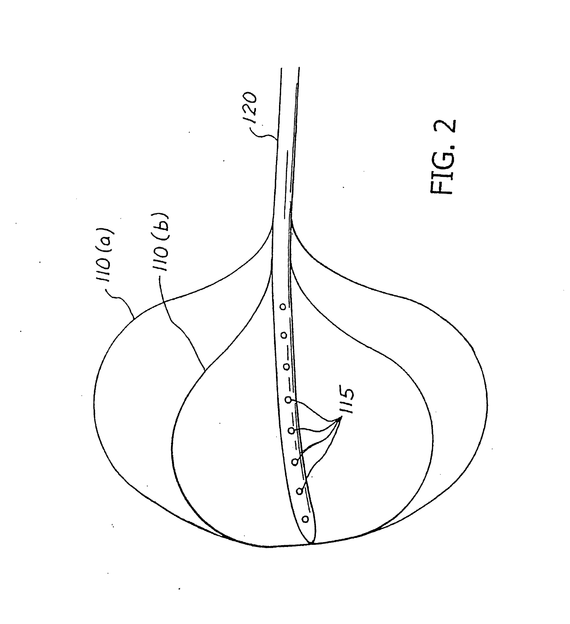 Balloon system and methods for treating obesity