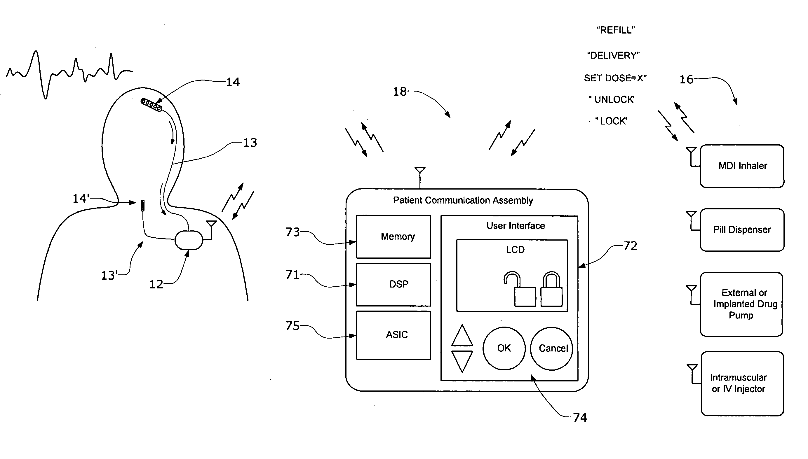 Systems and methods for characterizing a patient's propensity for a neurological event and for communicating with a pharmacological agent dispenser