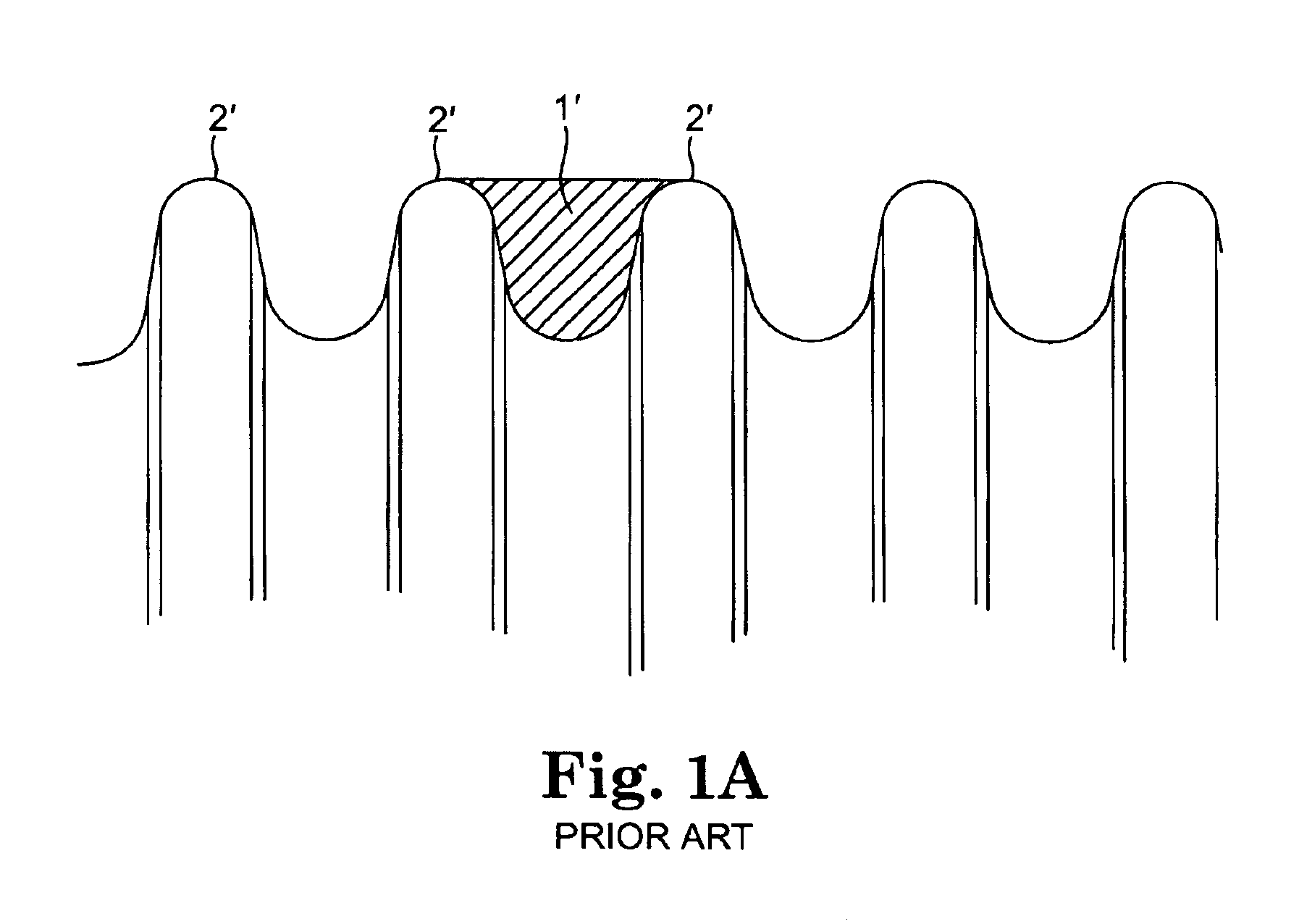 Implantable pump