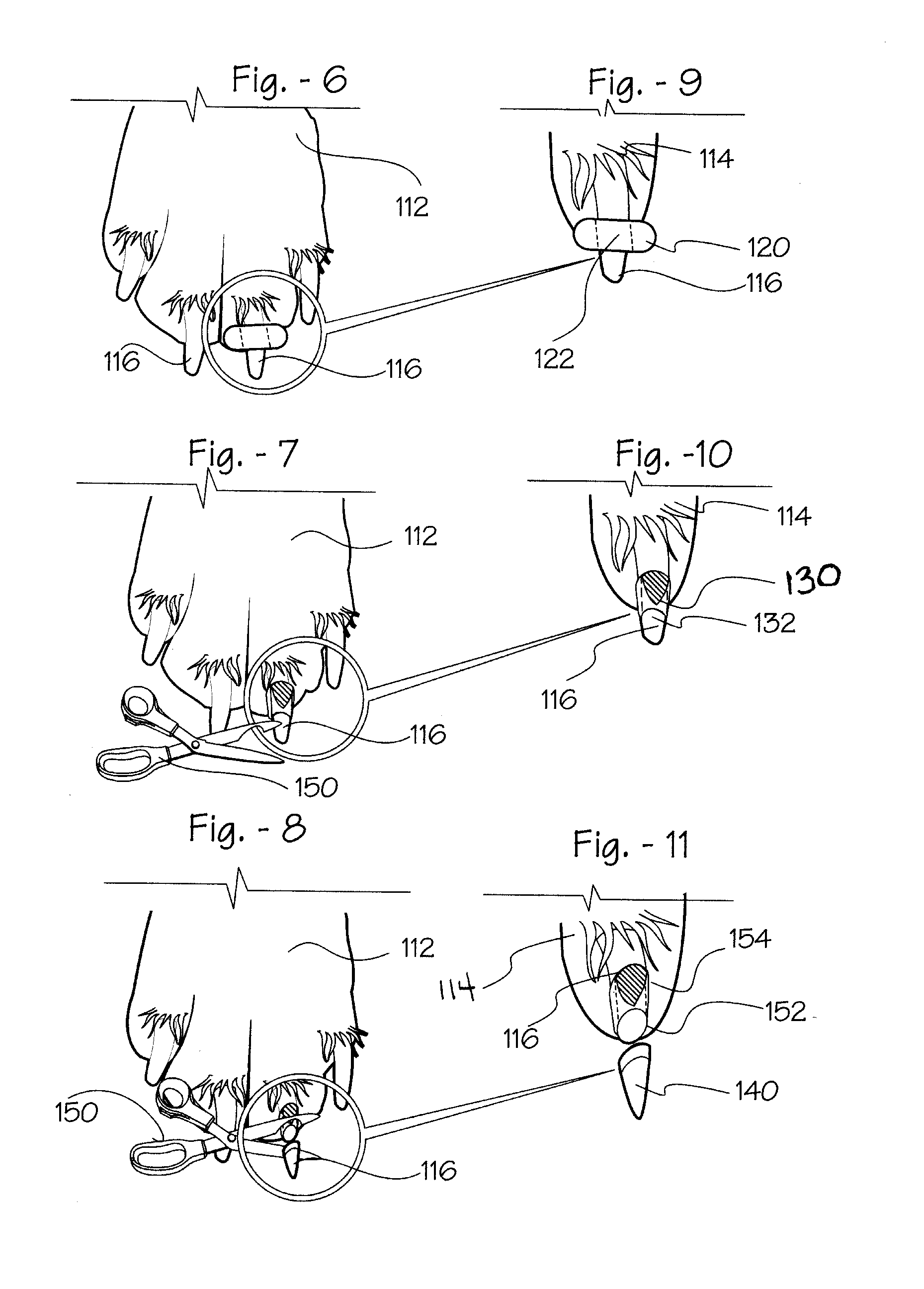 Nail dermis indicator & method of clipping nails