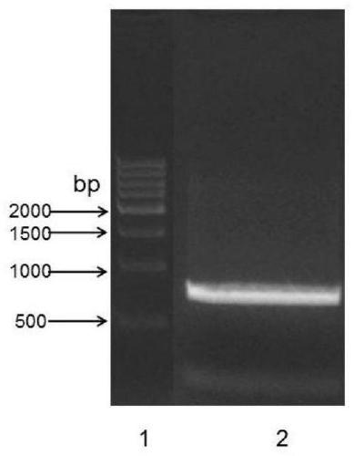 Latex enhanced immunoturbidimetric detection kit for retinol binding protein and clinical application thereof