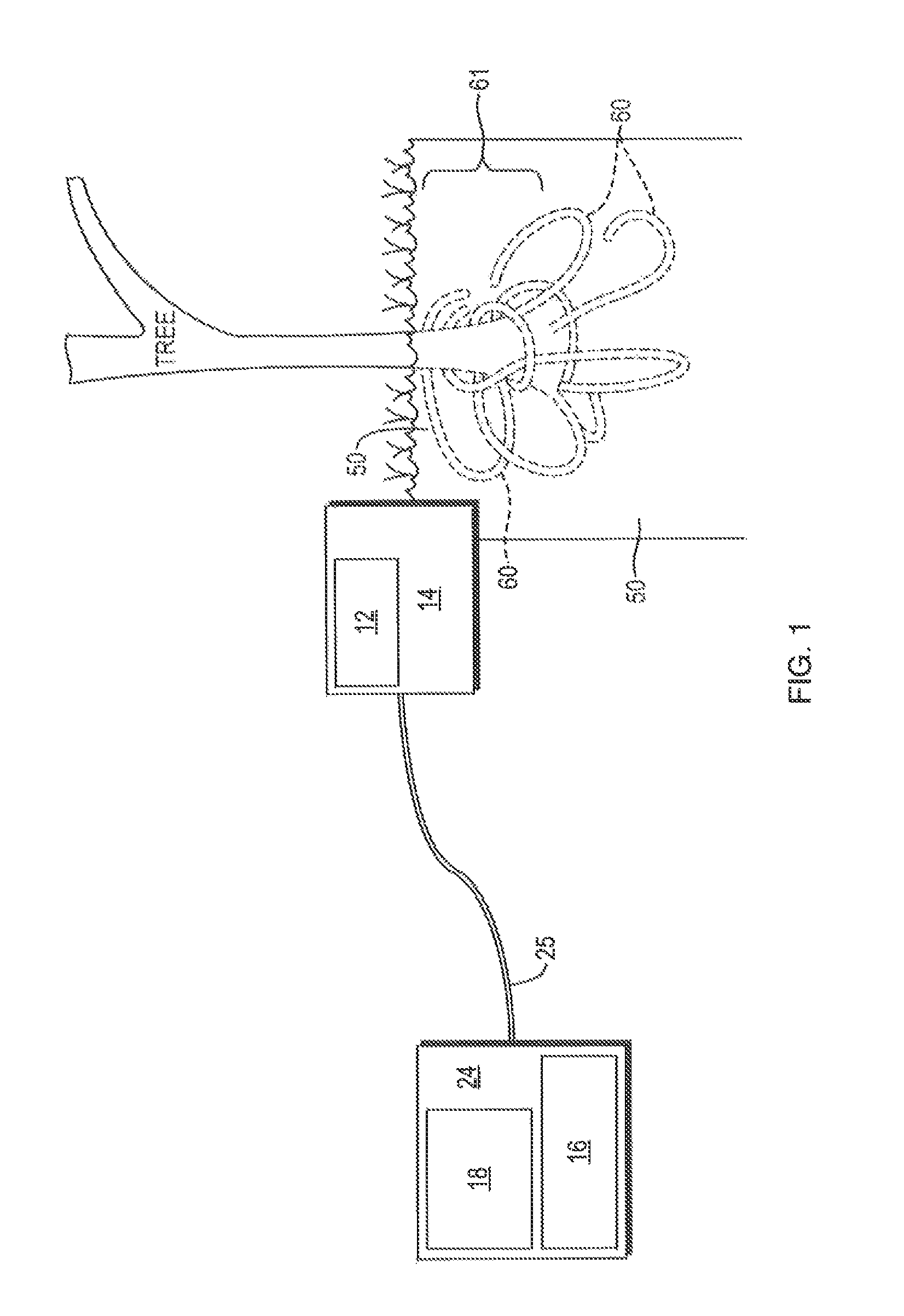 TREES-tree root examination, evaluation and standardization