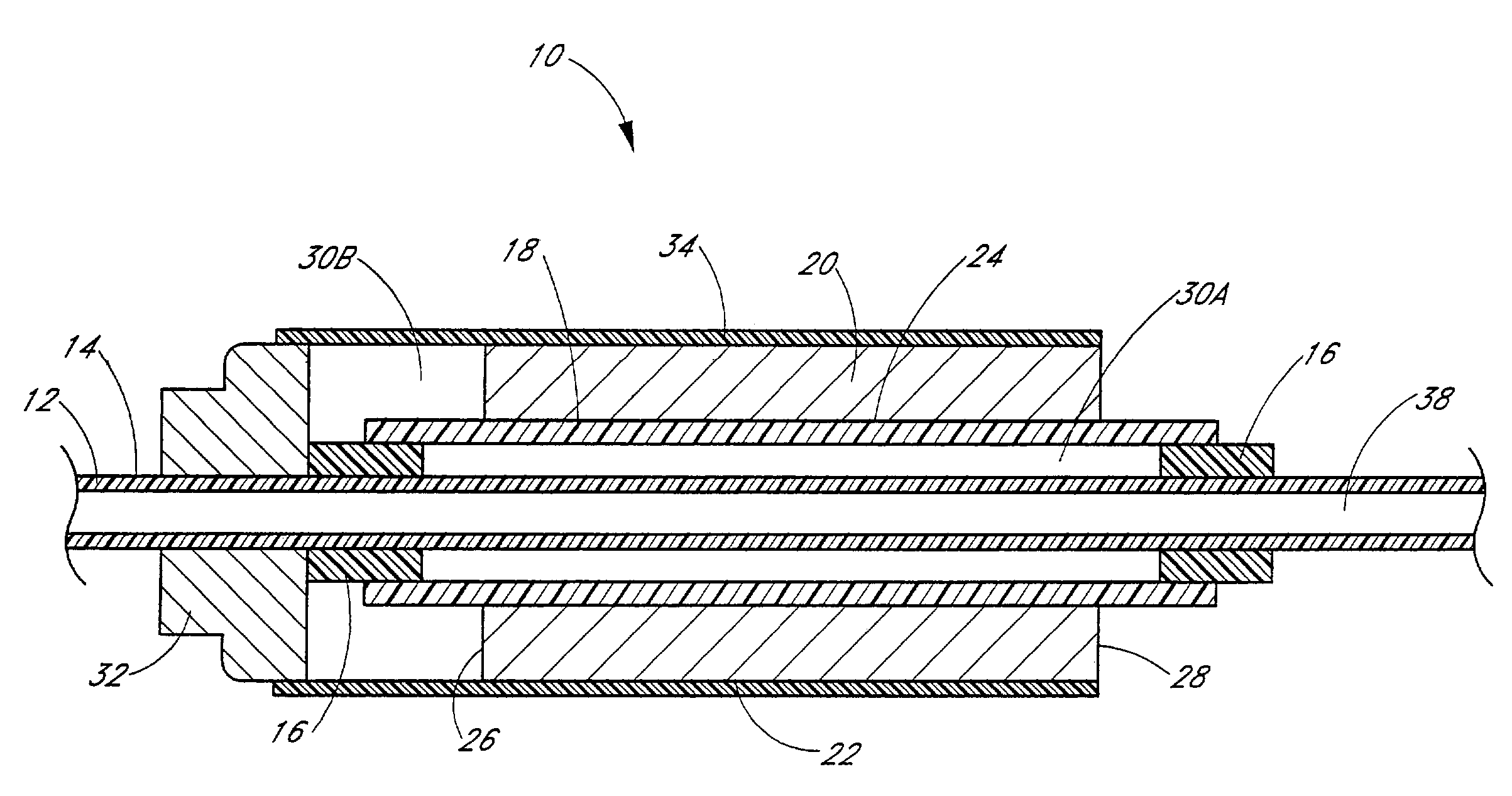 Ultrasound catheter with utility lumen