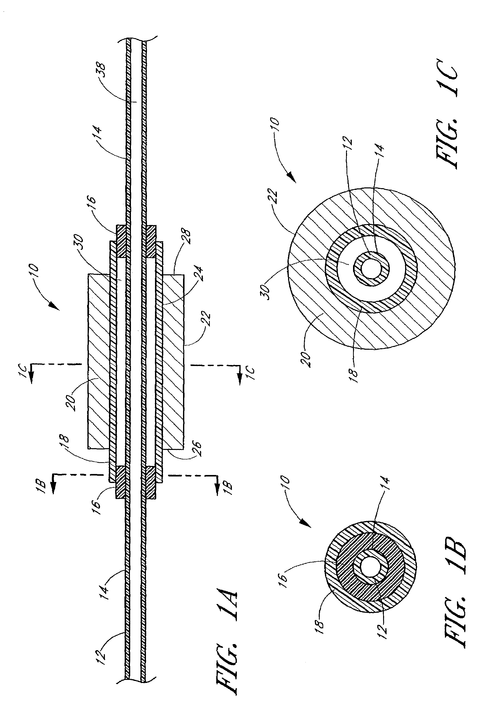 Ultrasound catheter with utility lumen