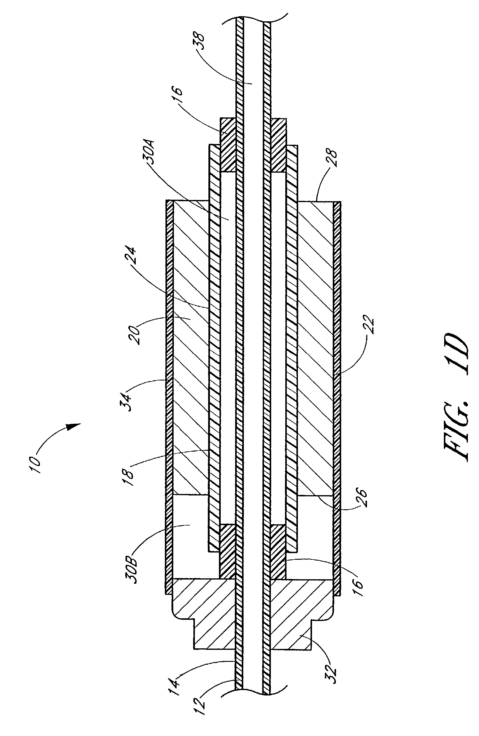 Ultrasound catheter with utility lumen