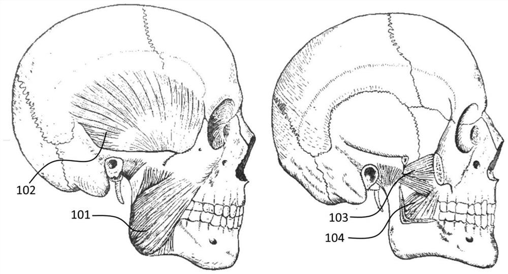 Masticatory muscle training instrument