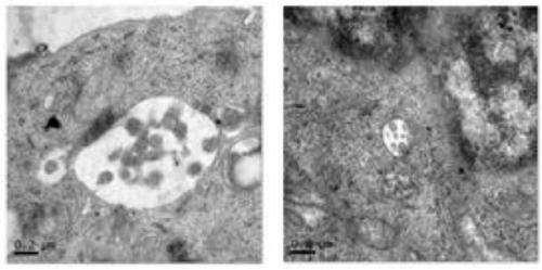 Cell line based on low-dose nano-TiO2 induction, and preparation method and application thereof