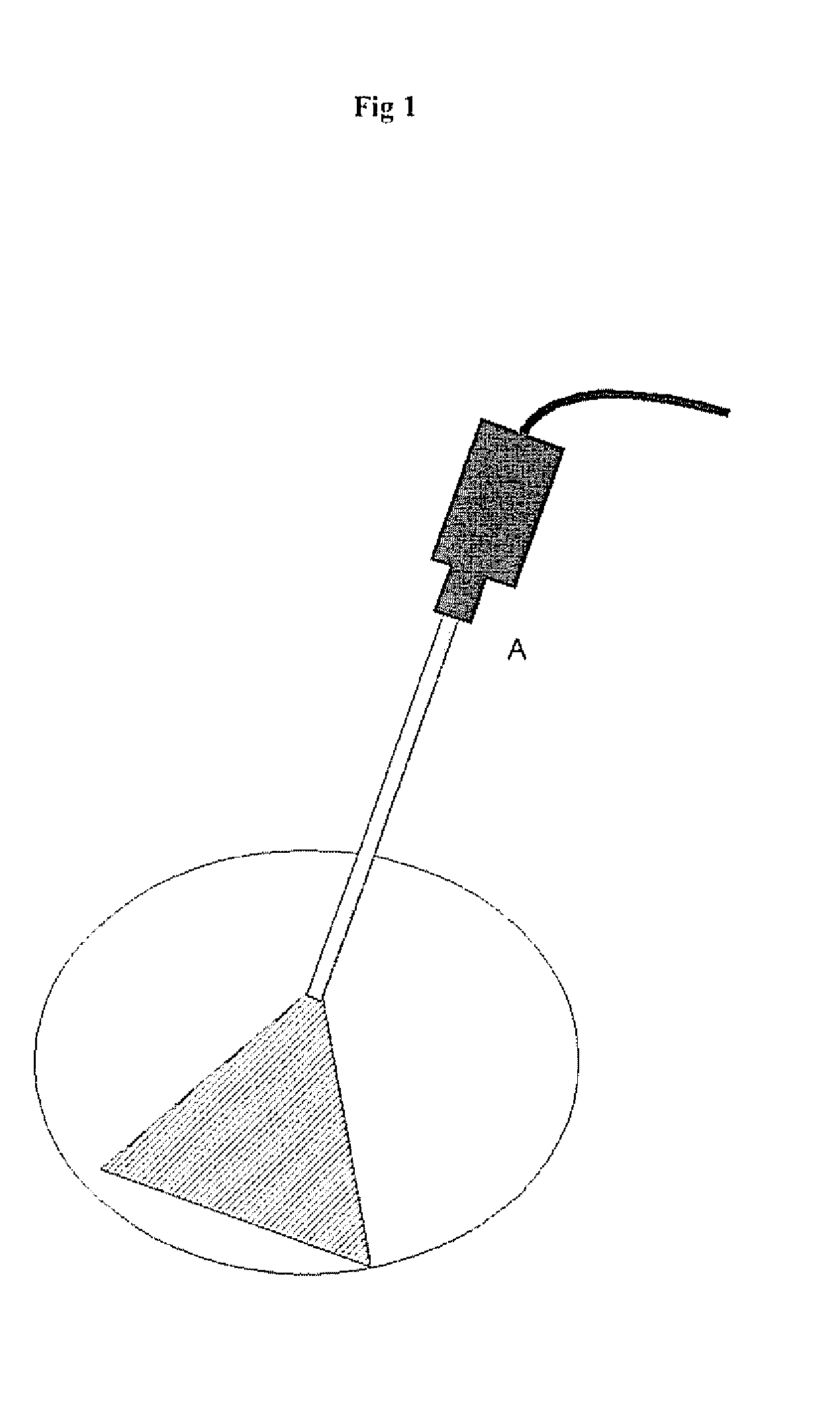 Endoscopic vision system