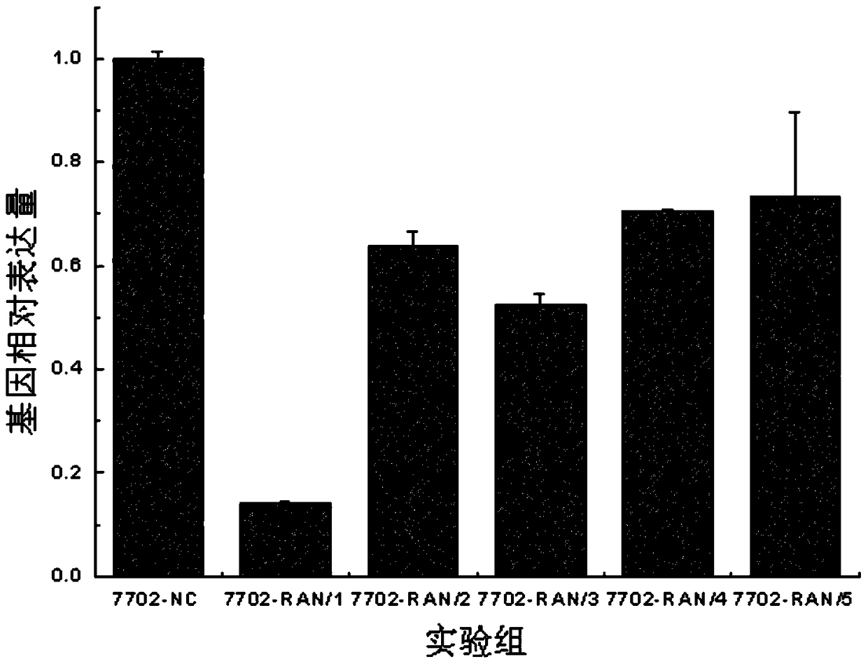 siRNA, recombinant vector and application of silencing human ran gene